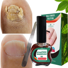 Ladda upp bild till gallerivisning, Nail Fungal Treatment Repair Essence Serum Paronychia Onychomycosis Anti Infection Care Foot Fungus Removal Gel