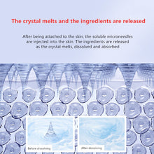 Ladda upp bild till gallerivisning, Micro-Needle Anti-wrinkle Forehead Hyaluronic Patches Acid Frown Lines Lifting Firming Anti-Aging Forehead Treatment
