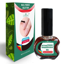 Ladda upp bild till gallerivisning, Nail Fungal Treatment Repair Essence Serum Paronychia Onychomycosis Anti Infection Care Foot  Fungus Removal Gel
