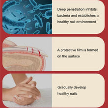 Ladda upp bild till gallerivisning, Nail Fungal Treatment Repair Essence Serum Paronychia Onychomycosis Anti Infection Care Foot  Fungus Removal Gel
