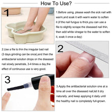 Ladda upp bild till gallerivisning, Nail Fungal Treatment Repair Essence Serum Paronychia Onychomycosis Anti Infection Care Foot  Fungus Removal Gel

